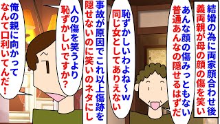 【漫画】彼「俺の親に失礼な事言ったな！謝っとけよ！」結婚の為に両家顔合わせの後義両親が母の顔の傷を笑いのネタに→不快だったので苦言を呈すると夫は義両親の味方をし…（スカッと漫画）【マンガ動画】 [upl. by Adehsor68]