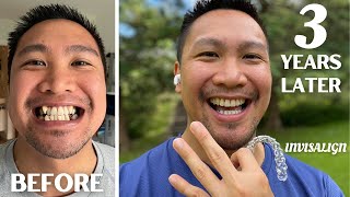 3 YEAR TEETH JOURNEY UPDATE  MONTH 38 UPDATE  Invisalign Journal [upl. by Lede]