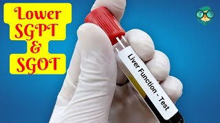 How to Lower SGPT and SGOT in 1 week How to Lower SGPT in 1 Week How to Lower SGOT in 1 Week [upl. by Salohcim838]