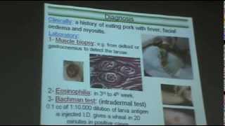 DrAzza Parasitology  Nematodes 6  Tissue Nematodes [upl. by Pelmas]