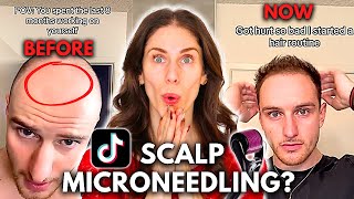 Can You Grow Back Hair With Scalp Microneedling Does Scalp Microneedling Work [upl. by Dodi575]