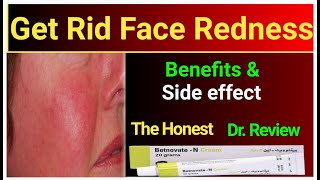 How to use betnovate n cream  benefits and side effects  Dr review betnovate cream [upl. by Galatia645]