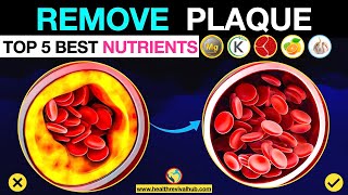 THE Nutrients to Remove Calcium Plaque from Arteries [upl. by Deming]