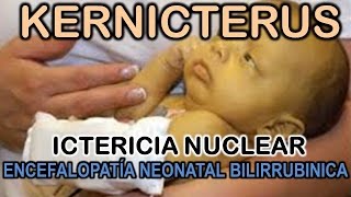 KERNICTERUS  ICTERICIA NUCLEAR  ENCEFALOPATÍA NEONATAL BILIRRUBINICA [upl. by Potash]