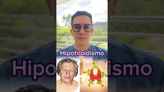 Hipotiroidismo no ignores estas señales  Dr William Guerrero medicina shorts [upl. by Lamahj539]