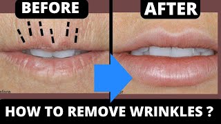 SMOKER LINES  FACE LIFTING EXERCISES FOR WRINKLES AROUND MOUTH  GET RID OF LIP LINES [upl. by Silvers]