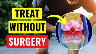 The Best Knee Arthritis Treatments Without Surgery [upl. by Patterman209]