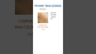 SKIN LESIONS Macule vs Papule [upl. by Naux]