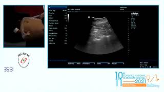 Pr M BENAZZOUZ L échographie dans les urgences abdominales non traumatiques [upl. by Janos]