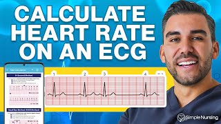 How to Calculate Heart Rate on ECG Easy Steps to Master Pulse Counting [upl. by Jaddan]