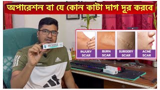 Mederma Advanced Scar Removal Gel  সার্জারির দাগ দ্রুতগতিতে দূর করে যে ক্রিম  Scar Removal Cream [upl. by Milka]