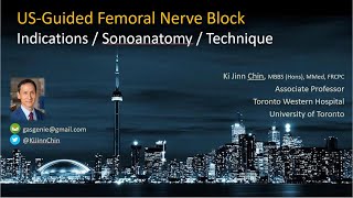 Ultrasoundguided Femoral Nerve Block [upl. by Sophi]