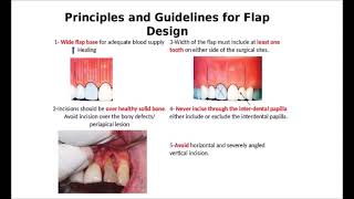 LECTURE 8 CHAP6 ENDODONTIC SURGERY  ENGLISH [upl. by Aohsoj]