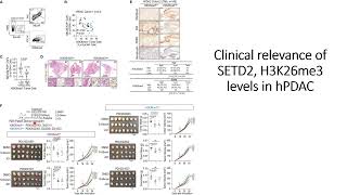 Clinical relevance of SETD2 H2K36me3 levels in hPDAC human pancreatic adenocarcinoma Code 736 [upl. by Mosier975]