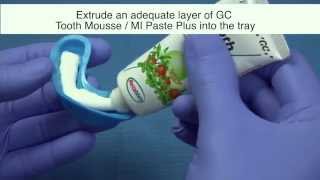 Как использовать Tooth Mousse и Mi Paste Plus [upl. by Adnauqahs935]