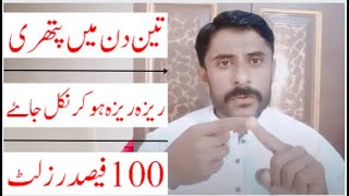 kidney stone treatment herbal  hakeem shahbaz baloch [upl. by Tobey]