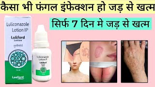 luliford lotion के फ़ायदे नुकसान  luliford lotion lagane ka sahi tarika uses review in hindi [upl. by Erbas]