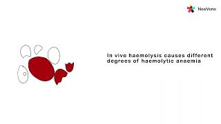 Venepuncture Preanalytical Haemolysis and Causes [upl. by Rennane36]