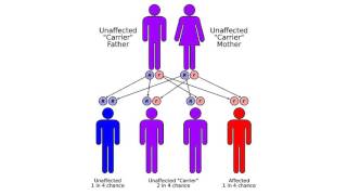 Congenital adrenal hyperplasia due to 11βhydroxylase deficiency [upl. by Meris]