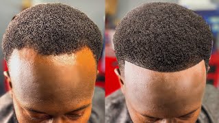 HOW TO FIX A BALDING RECEDING HAIRLINE  PERFECT HAIRCUT FIX [upl. by Althee]