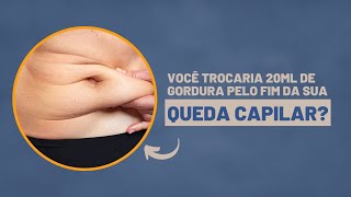 Célulastronco no tratamento da queda capilar  Dra Débora Cadore  Dermatologista Florianópolis [upl. by Dustie275]