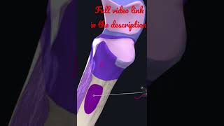 Ulna  The coronoid process Anatomy mbbs education [upl. by Lemire80]