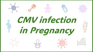 Congenital CMV infection [upl. by Ellehs]