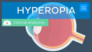 Farsightedness Hyperopia Definition causes symptoms diagnosis and treatment  Kenhub [upl. by Marget]