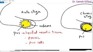 Systemic pathology 18  CNS 2 brain abscess and degenerations  DRSAMEH GHAZY [upl. by Alidia]