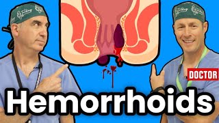 How To Get Rid Of Hemorrhoids [upl. by Gudrin]