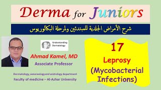 017 Leprosy Mycobacterial Infections د أحمد كامل [upl. by Jacob]