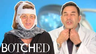 Dr Nassif Fixes Lisa’s Facelift Gone Wrong FULL TRANSFORMATION  Botched  E [upl. by Anid]