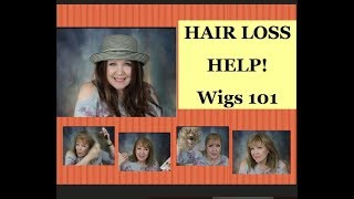 HAIR Loss Help Wigs amp Hairpieces 101  regrowth productscareoptions [upl. by Baggott]