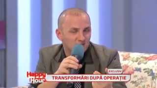 Mihai Traistariu  implant de par  partea a IIIa din 3   la 6 zile dupa operatie [upl. by Erbma]