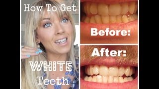 ❤ How To Get WHITE Teeth at Home Demo amp Actual Pictures ❤ [upl. by Haggerty]