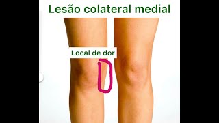 Lesão do ligamento colateral medial do joelho  torção do joelho  lesão ligamentar [upl. by Ahkos]