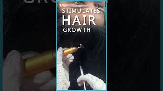 Female Hair Loss Solutions with PRP  Womens Hair Restoration Benefits AWISH Clinic [upl. by Rheta100]