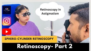 Retinoscopy Part 2  Static Retinoscopy for astigmatism  SpheroCylinder method [upl. by Eilyw360]