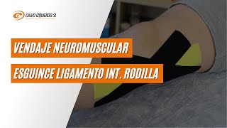 Vendaje neuromuscular para esguince del ligamento interno de rodilla [upl. by Kippy]