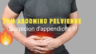 SCANNER ABDOMINOPELVIEN Appendice tuméfié avec épaississement pariétal [upl. by Stafford]