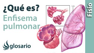 ENFISEMA PULMONAR  Qué es qué estructuras afecta síntomas signos causas y tratamiento [upl. by Renny133]