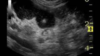 Ultrasoundguided needle biopsy of a jejunal lymph node in a dog [upl. by Eintruok]