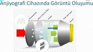 Anjiyografi Cihazı Üniteleri ve Görüntüleme [upl. by Kone]