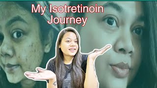 ISOTRETINOIN TABLETS Update after 1 Year  Does isotretinoin remove acne permanently [upl. by Nwaf780]