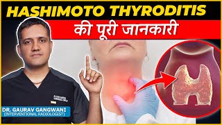 Complete Information About Hashimoto thyroiditis  Dr Gaurav Gangwami Interventional Radiologist [upl. by Ludeman]