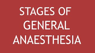 Stages Of General Anesthesia by Dr Shikha Parmar [upl. by Anoynek300]