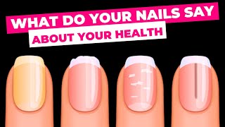 What Does Your Nails Tell You About Your Health [upl. by Marko]