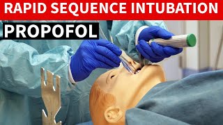 Propofol Diprivan Rapid Sequence Intubation [upl. by Alyson]