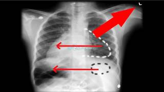 🔴 8 LES ANOMALIES A NE PAS RATER SUR RADIO THORAX  DR ASTUCE [upl. by Auqenwahs]