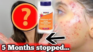 I STOPPED TAKING PANTOTHENIC ACID FOR 5 MONTHS STRAIGHT THIS IS WHAT HAPPENED Major skin update [upl. by Monro]